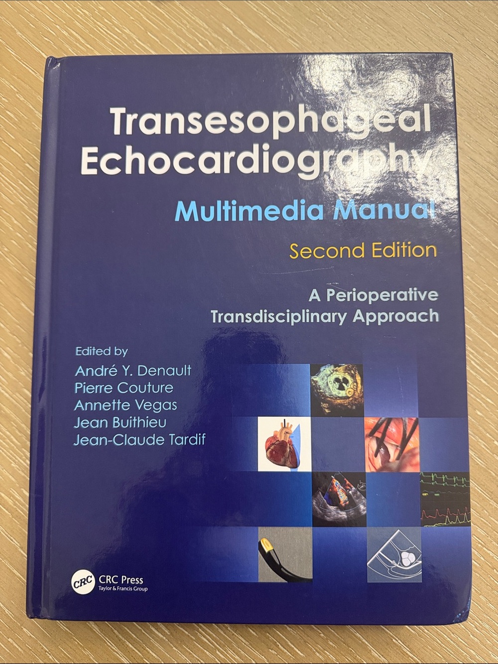 Transesophageal Echocardiography Multimedia Manual - Blue Cover